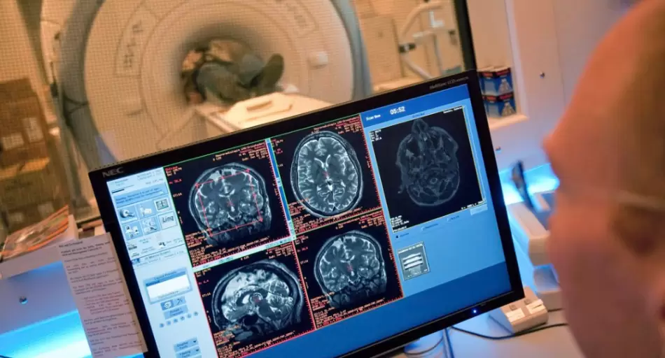 Rugby y boxeo: revelan daño cerebral 12 años después