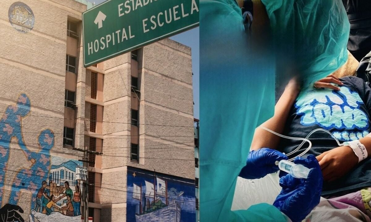 Niño de 13 años recibe el alta tras una grave mordedura de perro que requirió cirugía reconstructiva en Honduras