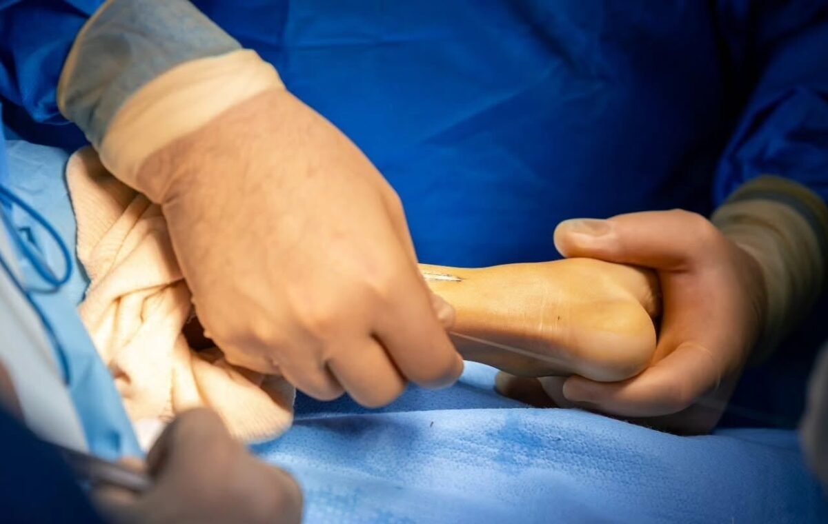 Alianza médica internacional beneficiará a niños salvadoreños con cirugías ortopédicas por pie varo