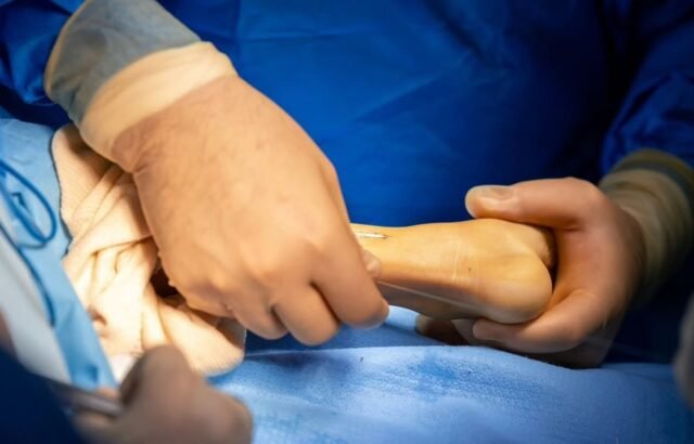 Alianza médica internacional beneficiará a niños salvadoreños con cirugías ortopédicas por pie varo