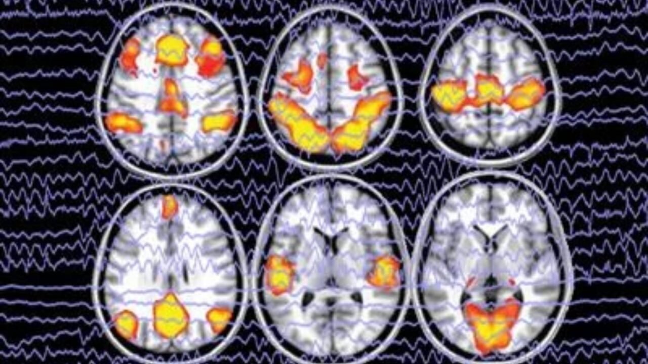 Crean una IA de “lectura de mente”: puede reconstruir lo que estás mirando a partir de un escáner cerebral