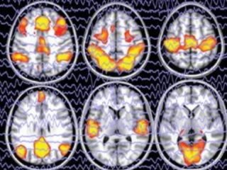 Crean una IA de “lectura de mente”: puede reconstruir lo que estás mirando a partir de un escáner cerebral
